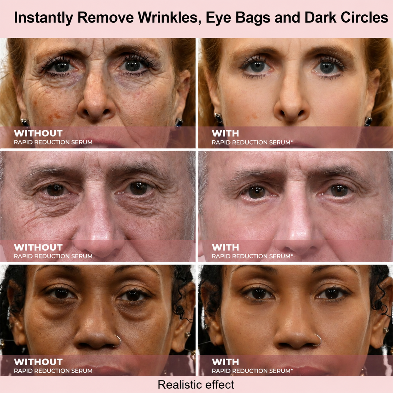 Effective in One Minute - Cougex™ Rapid Wrinkle-Reducing Serum for Wrinkles, Bags & Dark Circles