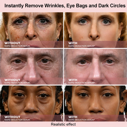 Effective in One Minute - Cougex™ Rapid Wrinkle-Reducing Serum for Wrinkles, Bags & Dark Circles