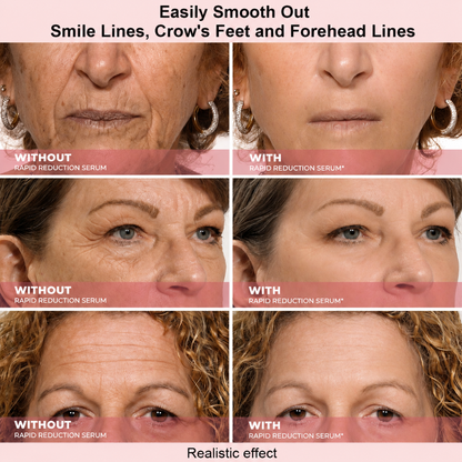 Effective in One Minute - Cougex™ Rapid Wrinkle-Reducing Serum for Wrinkles, Bags & Dark Circles